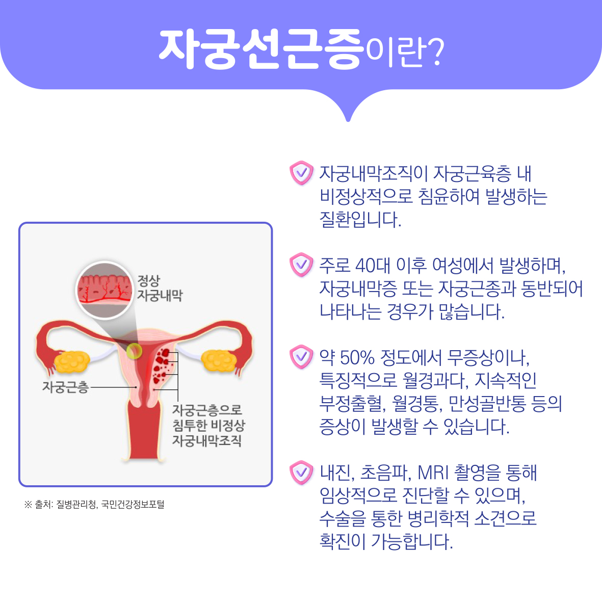 초음파 유도하 고강도초음파 집속술 (자궁근종, 자궁선근증) 이미지4