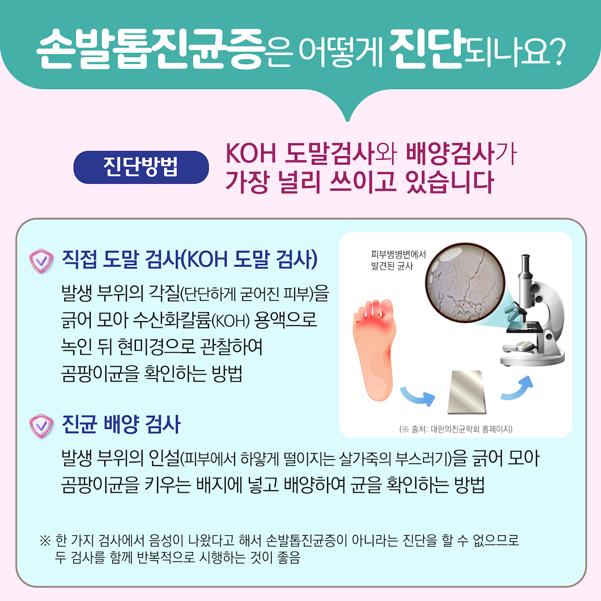 레이저를 이용한 손발톱진균증 치료술 이미지3