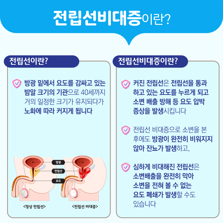 이식형결찰사를 이용한 전립선결찰술 이미지2