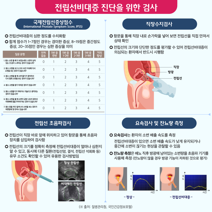 이식형결찰사를 이용한 전립선결찰술 이미지4
